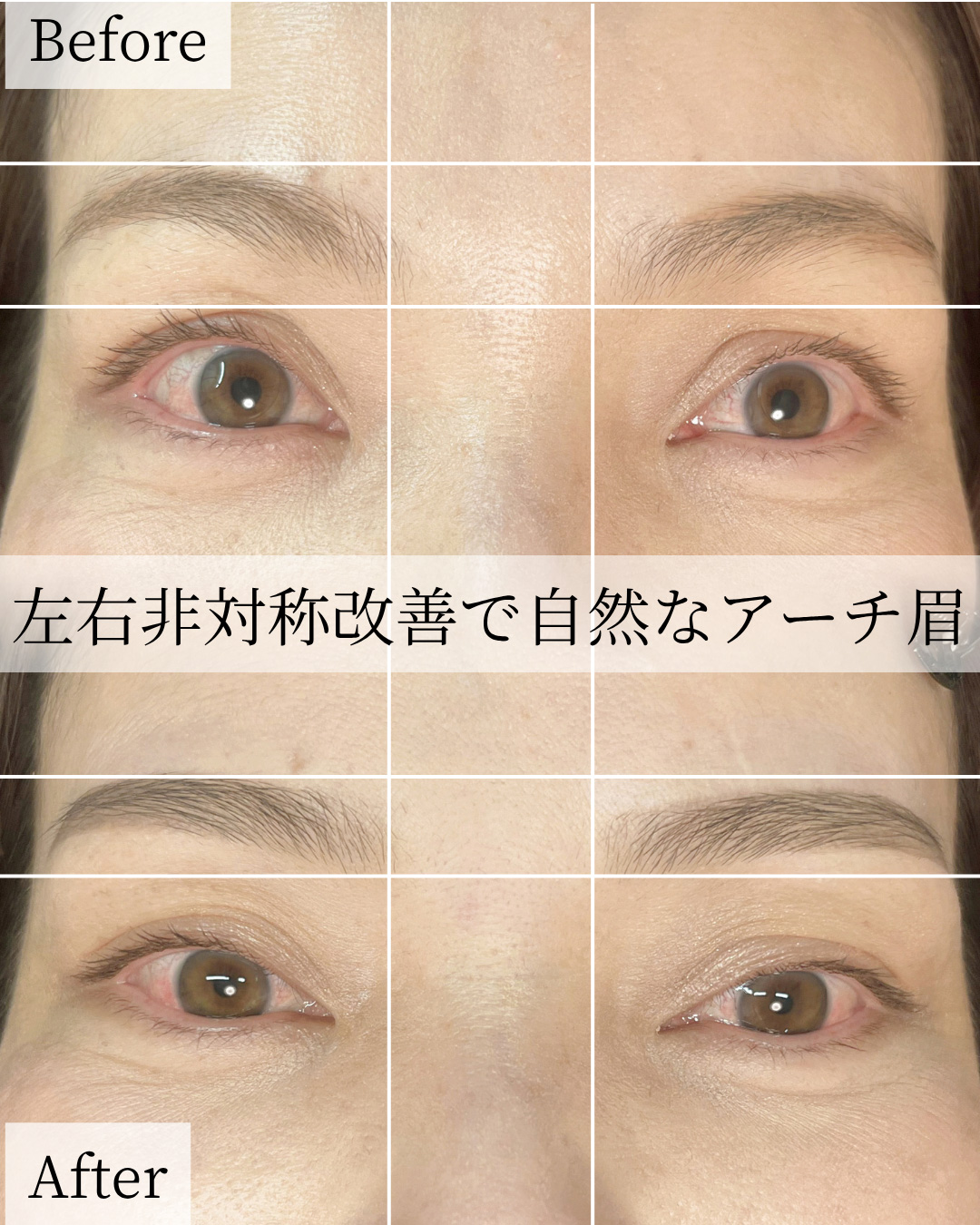 症例画像