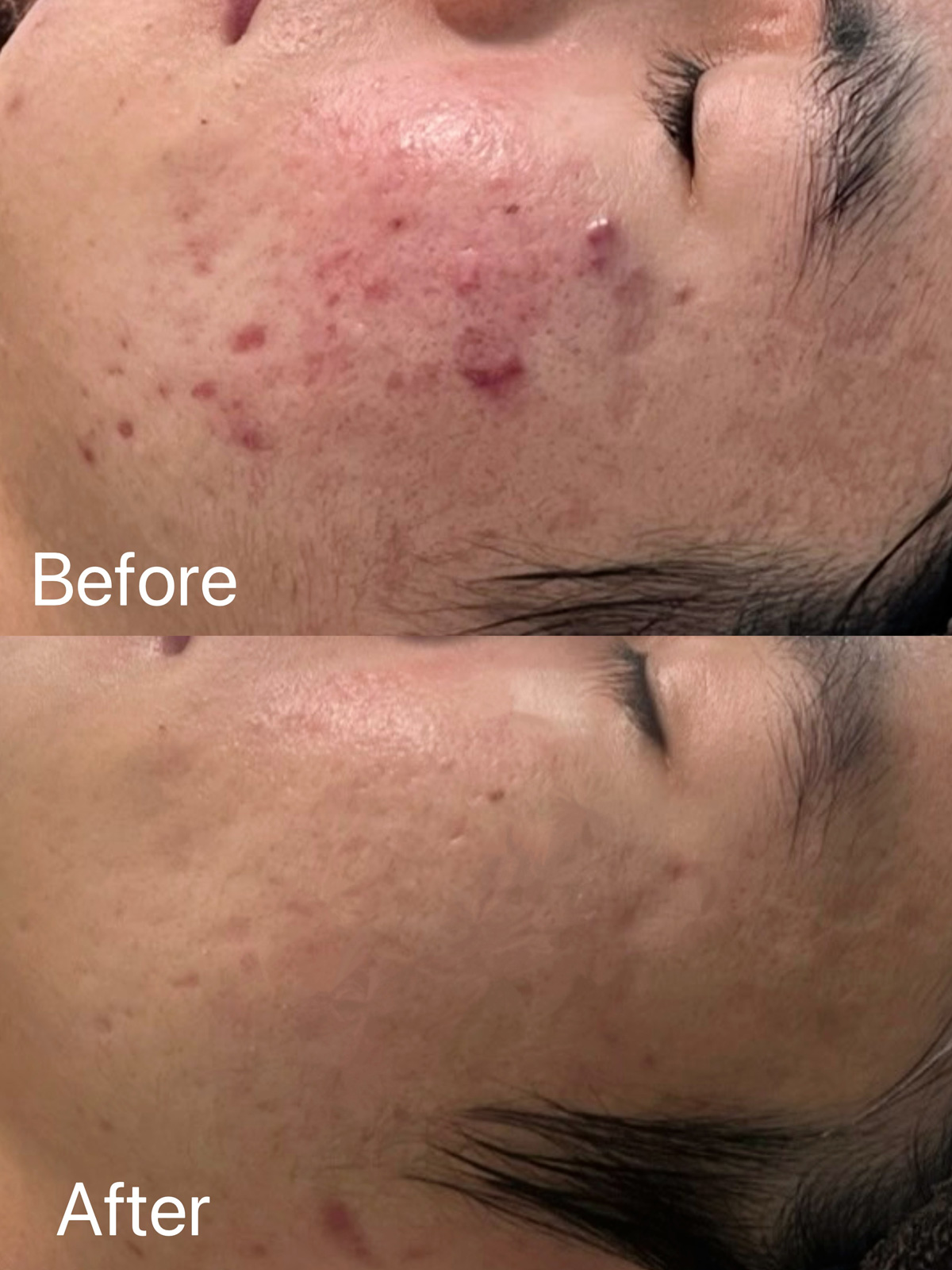 症例画像